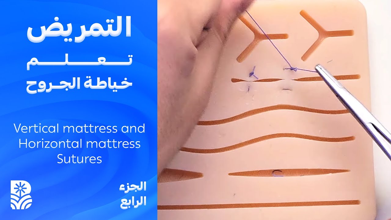 تعلم خياطة الجروح - Vertical mattress and Horizontal mattress