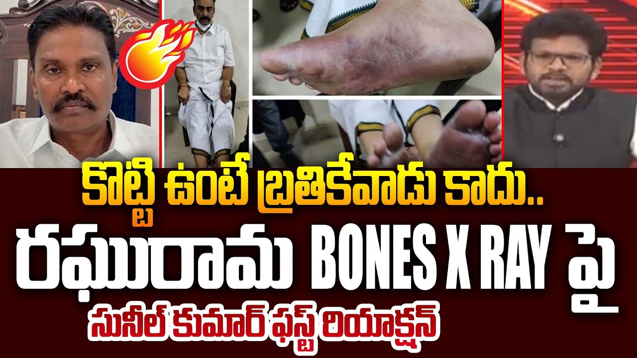 Ex IPS Sunil Kumar FIRST Reaction Over Raghuramakrishnam Raju X Ray Report | 99TV Telugu
