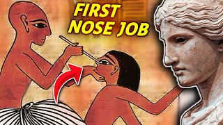 When Did Nose Jobs Become Popular? The Crazy History of Nose Jobs