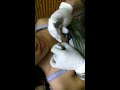 Dermal piercing