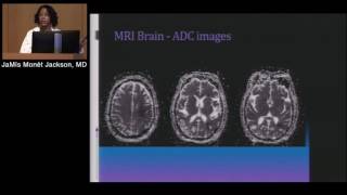 Neuroradiology: Basic Interpretation of CT & MRI (JaMís Jackson, MD)