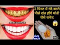 सिर्फ 2 मिनट में पीले गंदे दांतों को मोती की तरह चमका देगा यह घरेलू नुस्खा / Teeth whitening remedy