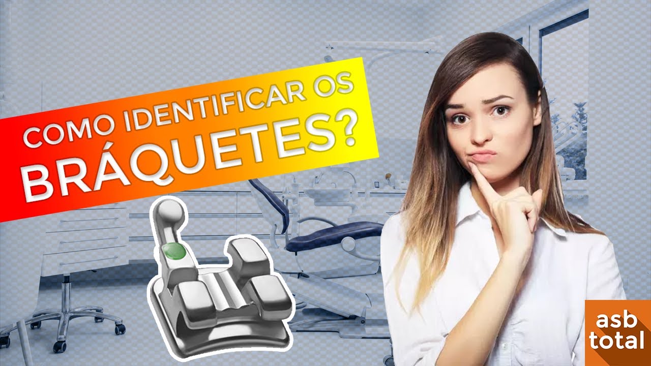 COMO IDENTIFICAR OS BRÁQUETES | ASB TOTAL
