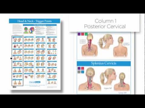 Head And Neck Trigger Point Chart