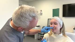 Treating a Gummy Smile with Botulinum Toxin | Cosmetic Courses, Mr Adrian Richards