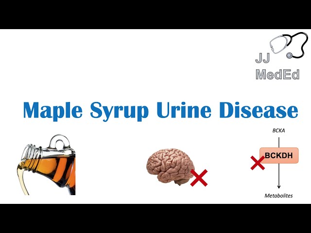 Maple Syrup Urine Disease maple-syrup-urine-disease