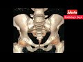 CT Scan Hip Joint || CT Scan  Pelvis With Both Hip Joints || VRT || #Radiology #Ctscan #Diagnose