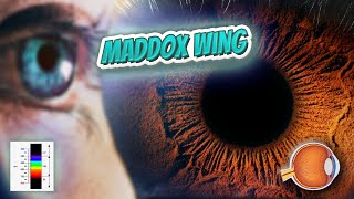 Maddox wing - Your EYEBALLS - EYNTK 👁️👁️💉😳💊🔊💯✅