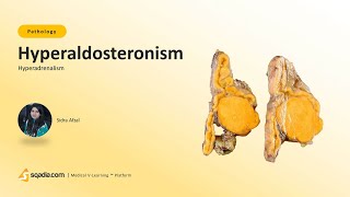 Hyperadrenalism | Hyperaldosteronism | Medical Student Pathology Education