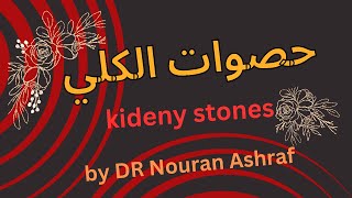حصوات الكلي( kideny stones)