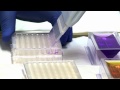 Developing a Candidate Ebola Vaccine