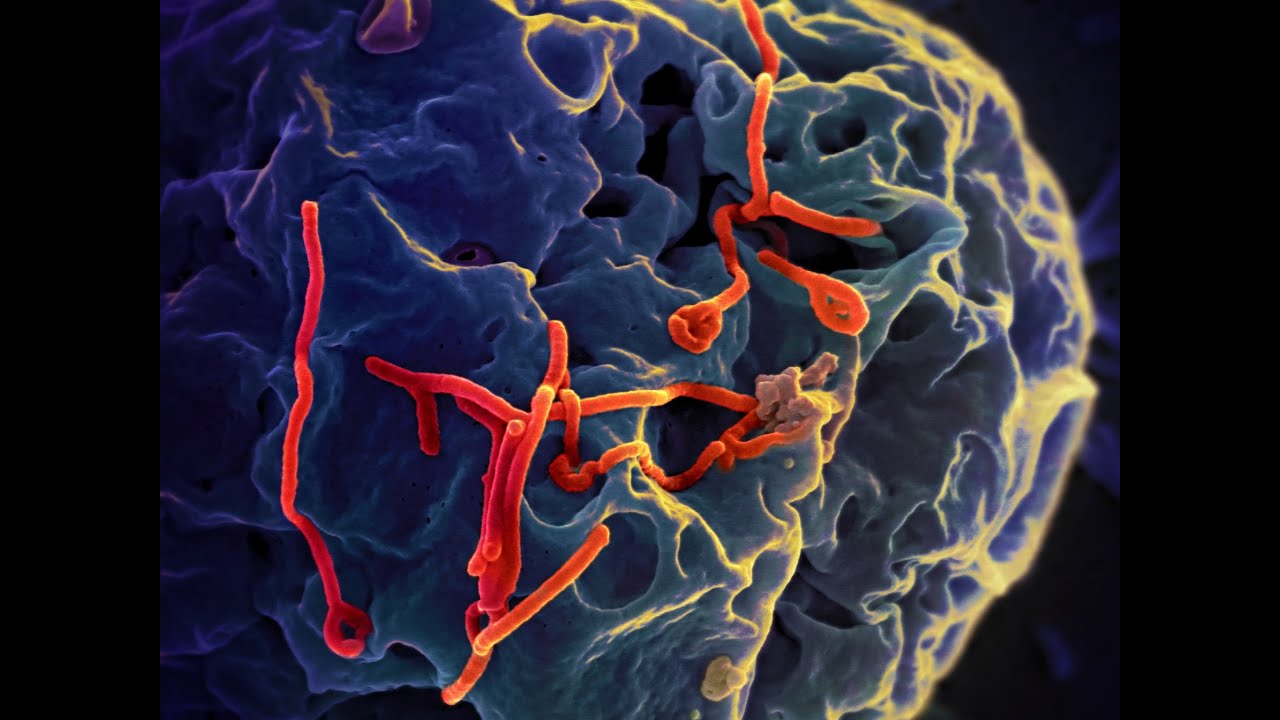 Developing a Candidate Ebola Vaccine