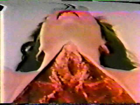 German Autopsy