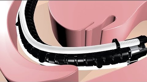 Flex® Robotic System Animation - Penn State Health