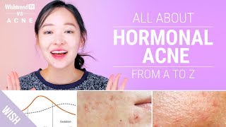 How to Cure Hormonal Acne : Lifestyle & Skincare Tips! | Wishtrend TV VS ACNE