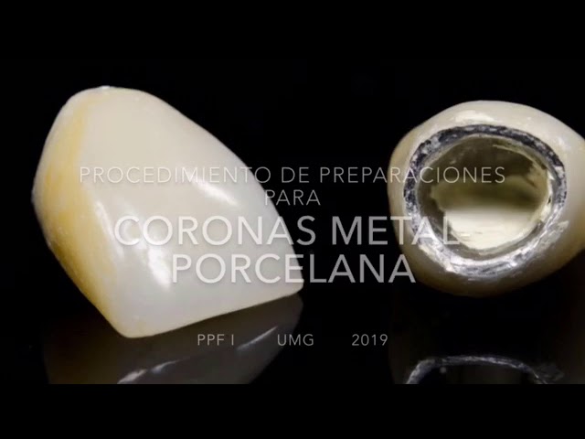 SOLUTION: Protocolo de elaboración corona metal-porcelana - Studypool