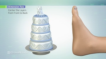 DynaBunion™ 4D Minimal Incision Bunion Correction - Patient Education Video