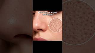 #pcosawareness #pcos #oilyskin #combinationskin #health #fy #foryoupage #fyp