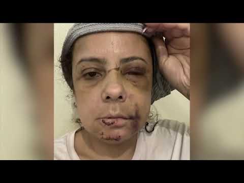 New Jersey woman who 'fought for her life' during trip to Turks and Caicos hopes to warn travelers