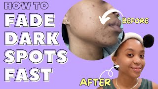 How To Fade Dark Spots Fast || Easy Routine With Real Results (*Photos Included*)