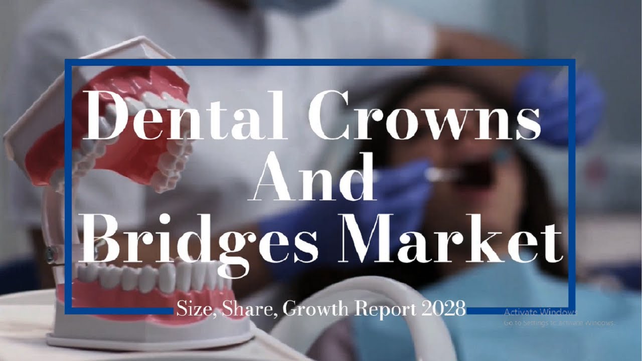Dental Crowns And Bridges Market Size, Share, Growth 2028 - YouTube