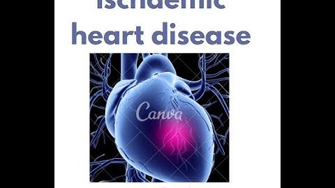 Ischemic Heart Disease in under 2 mins!