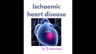 Ischemic Heart Disease in under 2 mins!