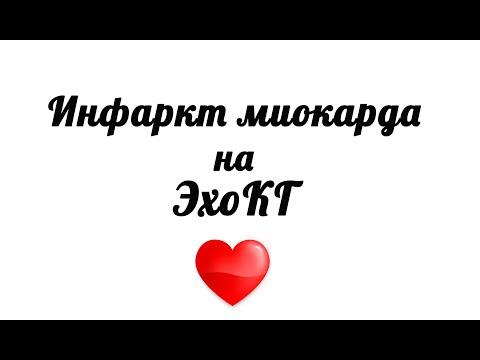 Инфаркт миокарда на эхокардиографии и ЭКГ