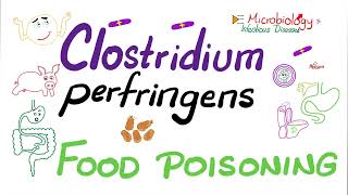 Clostridium perfringens Food 🥘 Poisoning 🤮 | Microbiology 🧫 & Infectious Diseases screenshot 2