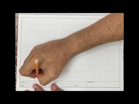 Video: ¿Qué es una cuadrícula de arranque?