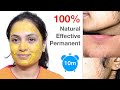 ಮುಖದ ಕೂದಲಿಗೆ ಶಾಶ್ವತ ಪರಿಹಾರ | Permanently Remove Facial Hair At Home In 10m - 100% Natural Effective