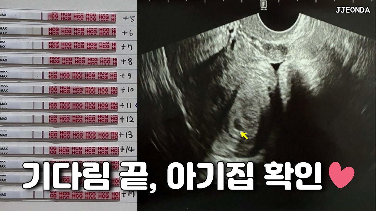 시험관브이로그:: 긴장된 첫 초음파, 아기집은 보였지만 조금 작다네요💧(난임브이로그 임신준비 난임병원 임밍아웃 일상브이로그 먹방브이로그)
