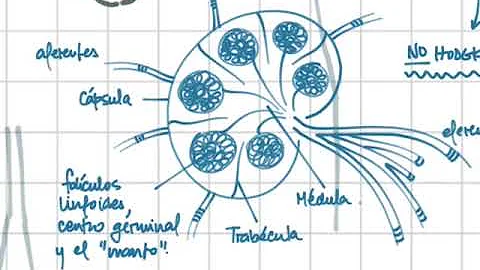 ¿Se clasifica el linfoma como leucemia?