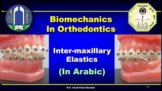 Intermaxillary Elastics in Orthodontics (In Arabic)
