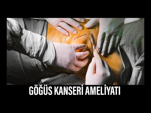 MEME KANSERİ AMELİYATI, TÜM SÜREÇ, AMELİYAT HEMŞİREM DE KANSERİ YENMİŞ