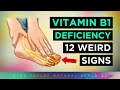 12 Strange Signs Your Body NEEDS Vitamin B1