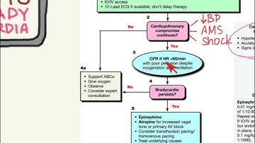 PALS 07: Bradycardias