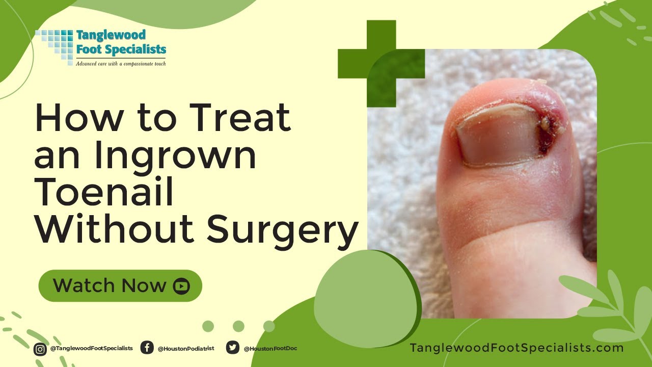 What is Ingrown Toenail removal surgery? How does it work? Does it hurt?