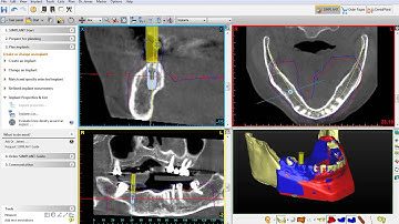 4. How to use the guide tubes function