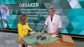 Kronisk stress ger "fettlever" - så får du en frisk lever - Malou Efter tio (TV4)