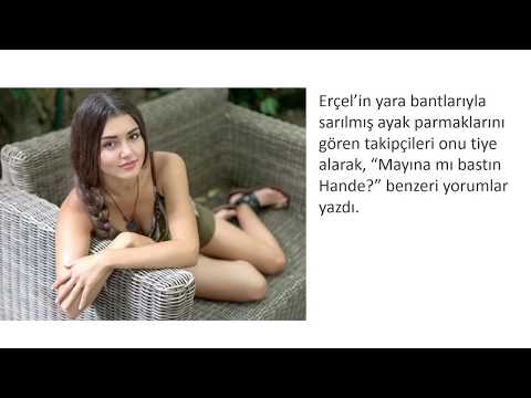 Hande Erçel’in ayakları alay konusu oldu