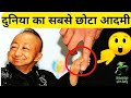 दुनिया का सबसे छोटा इंसान देखकर हैरान हो जाओगे || #Shorts || knowledge with suraj ||