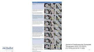 3.3.26 Multi-Modality Imaging Weekly Webcast