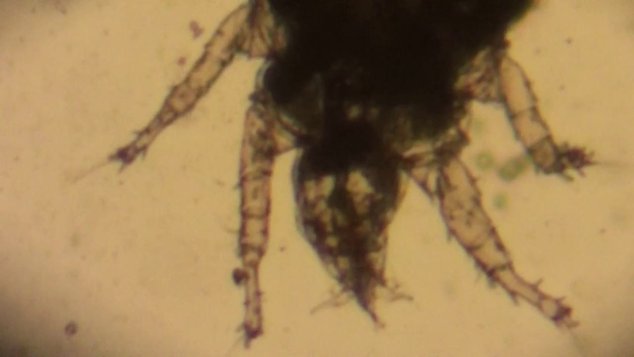 Под Микроскопом: Живые Клещи На Мандарине? Откуда? Почему? Что Делать ...