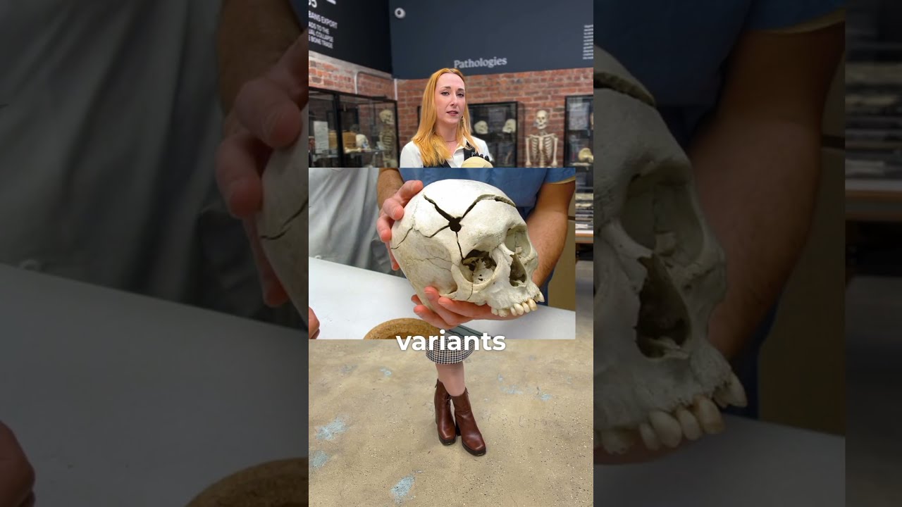 What Is Forensic Anthropology 