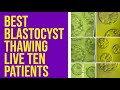 Ten Patients #blastocyst5AA 4AA thawing post thaw survival100% #ivf #icsi #infertility