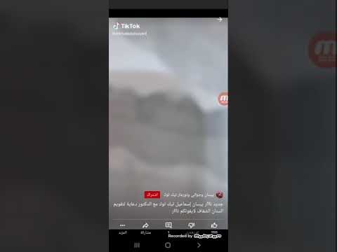 بيسان اسماعيل تحط تقويم اسنان الشفاف