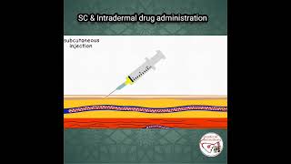 ПОДКОЖНЫЕ (SC) И ВНУТРИКОЖНЫЕ ИНЪЕКЦИИ | АНИМИРОВАННОЕ ОБЪЯСНЕНИЕ |