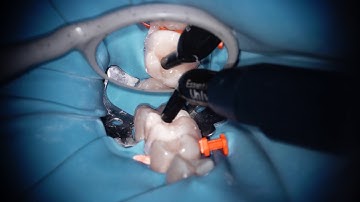 class 2 full restoration