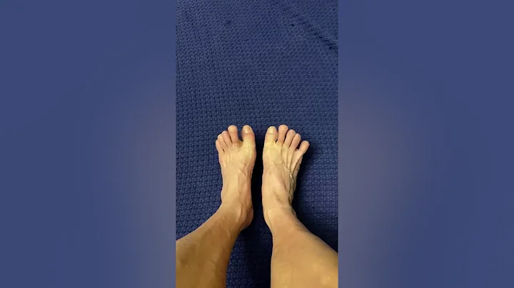 Plantar Fasciitis: Train Toes to Spread Out for Pa...